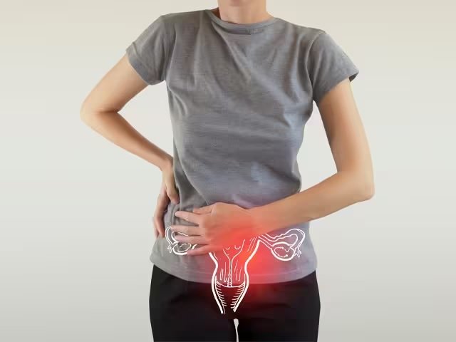 Ovarian Cancer